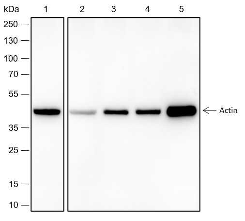 Recombinant Alpha Skeletal Muscle Actin Monoclonal Antibody (AN301797L)