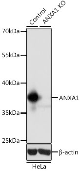 (KO Validated) ANXA1 Polyclonal Antibody (E-AB-60192)