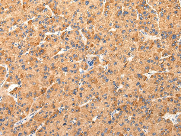AQP7 Polyclonal Antibody (E-AB-17680)