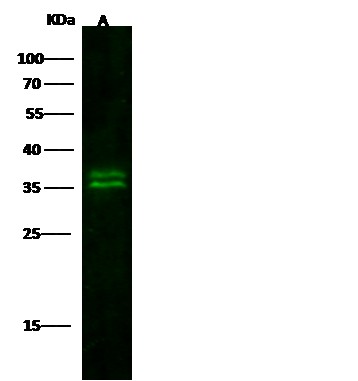 Recombinant KLK8/Kallikrein 8 Monoclonal Antibody (AN300243P)
