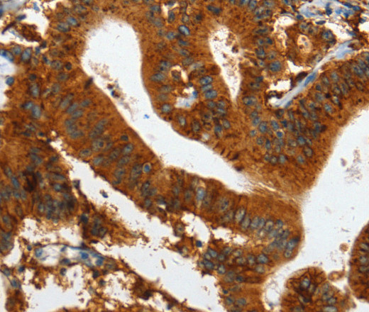 IL20RA Polyclonal Antibody (E-AB-10109)
