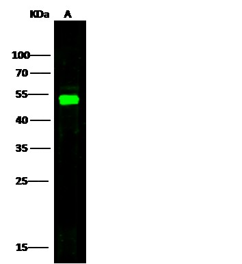 Recombinant E-Selectin/CD62e/SELE Monoclonal Antibody (AN300321P)