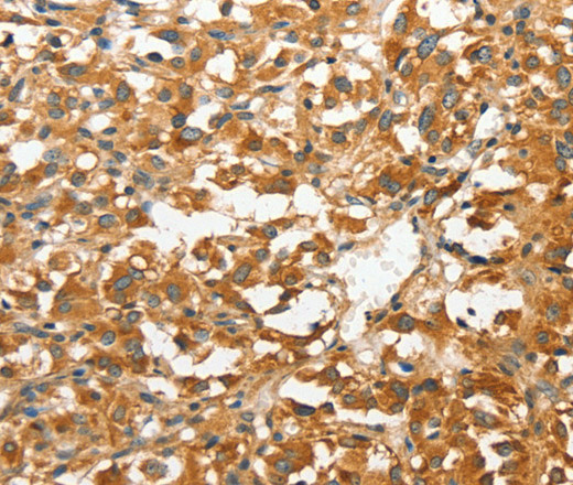 ANXA9 Polyclonal Antibody (E-AB-14572)