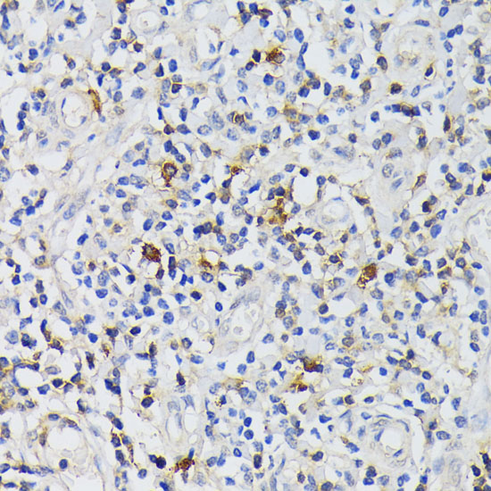 CD3E Polyclonal Antibody (E-AB-60431)