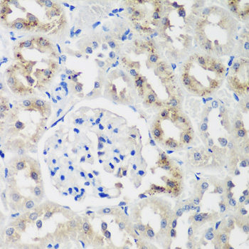 NEDD4L Polyclonal Antibody (E-AB-62392)