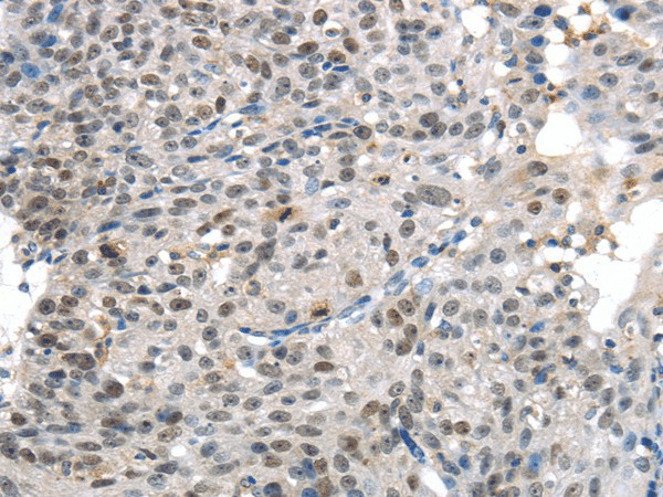 KDM5C Polyclonal Antibody (E-AB-17519)