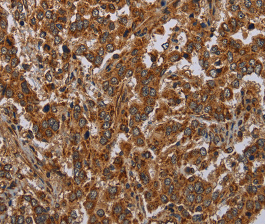 ATP2A1 Polyclonal Antibody (E-AB-16608)