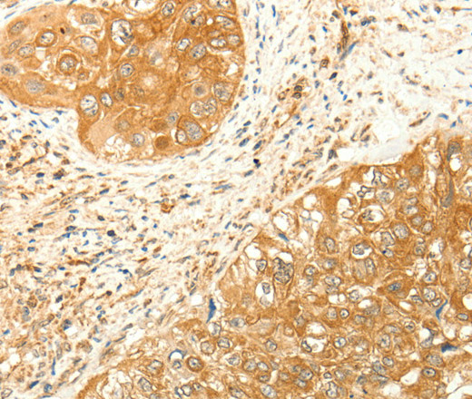 RARRES1 Polyclonal Antibody (E-AB-16100)