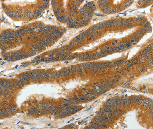 RGS2 Polyclonal Antibody (E-AB-10580)