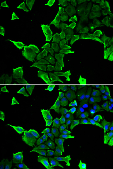 NCS1 Polyclonal Antibody (E-AB-64734)