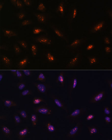 LLPH Polyclonal Antibody (E-AB-65352)