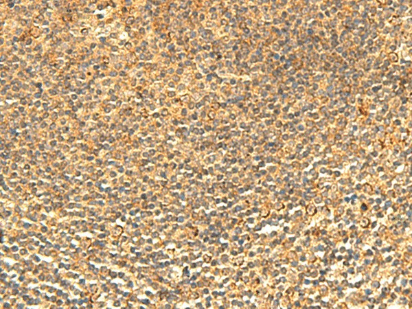 ABHD10 Polyclonal Antibody (E-AB-52876)
