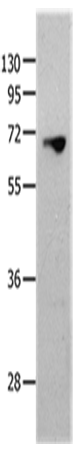 MMP25 Polyclonal Antibody (E-AB-15779)