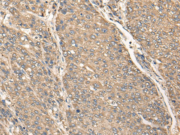 C17orf67 Polyclonal Antibody (E-AB-18558)