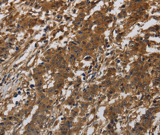 ITGB7 Polyclonal Antibody (E-AB-16525)