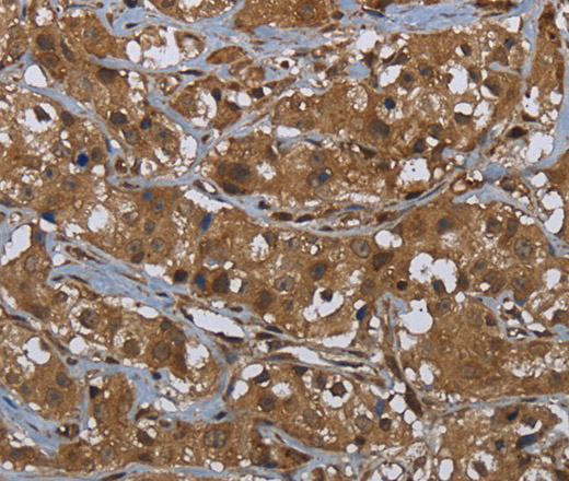 GCK Polyclonal Antibody (E-AB-15062)