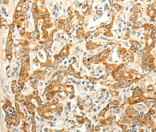 ERG Polyclonal Antibody (E-AB-10356)