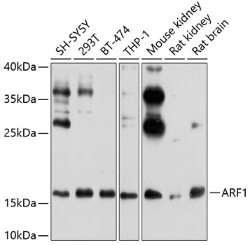 ARF1 Polyclonal Antibody (E-AB-92372)