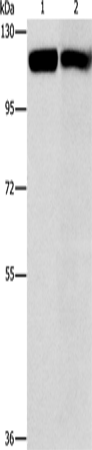 CBL Polyclonal Antibody (E-AB-16288)