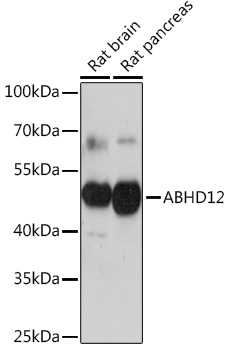 ABHD12 Polyclonal Antibody (E-AB-91864)