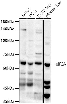 eIF2A Polyclonal Antibody (E-AB-91470)