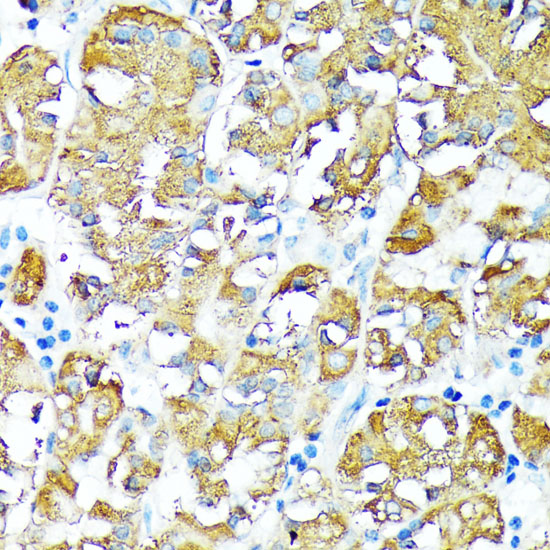 TNFR1 Polyclonal Antibody (E-AB-66479)