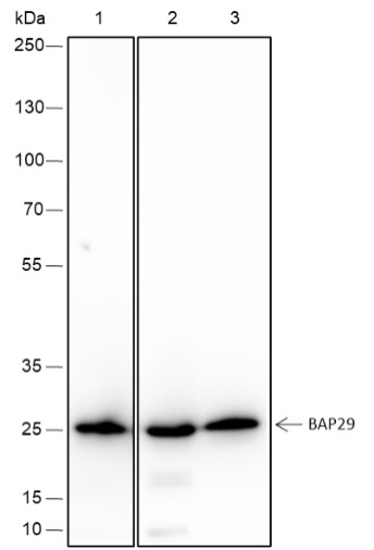 Recombinant BAP29 Monoclonal Antibody (AN301714L)