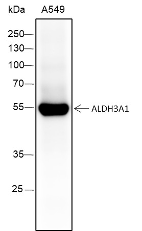 Recombinant ALDH3A1 Monoclonal Antibody (AN301430L)