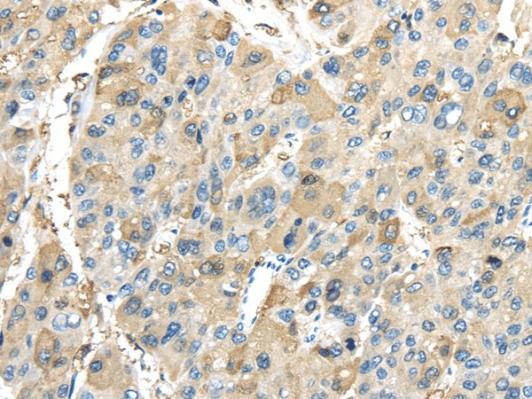 INHBB Polyclonal Antibody (E-AB-17341)
