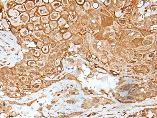 IL6ST Polyclonal Antibody (E-AB-52510)