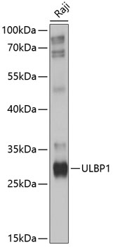 ULBP1 Polyclonal Antibody (E-AB-90184)