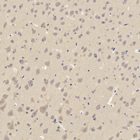 TAC1 Polyclonal Antibody (E-AB-70320)
