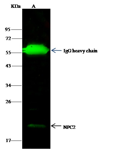 Recombinant NPC2 Monoclonal Antibody (AN300054P)
