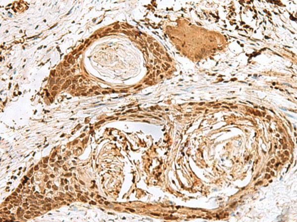 SNAPC1 Polyclonal Antibody (E-AB-18821)