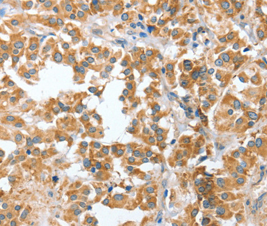 CIAPIN1 Polyclonal Antibody (E-AB-11083)