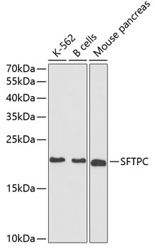 SFTPC Polyclonal Antibody (E-AB-60468)