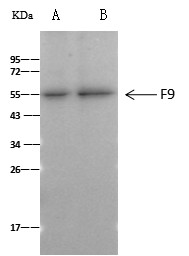 Recombinant Coagulation Factor IX/FIX/F9 Monoclonal Antibody (AN300234P)