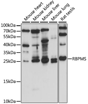 RBPMS Polyclonal Antibody (E-AB-91143)