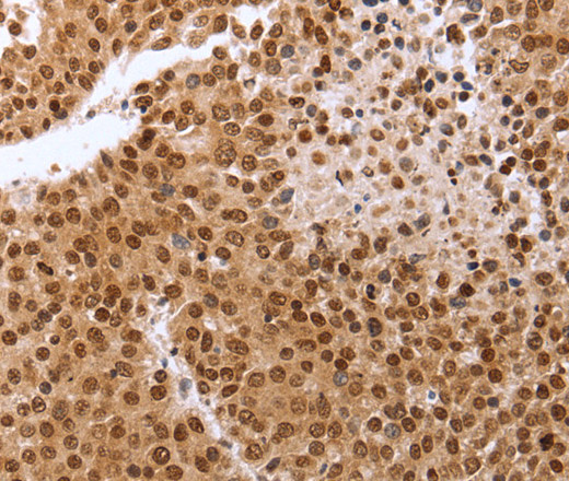 PTTG1 Polyclonal Antibody (E-AB-12630)