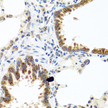 C8orf4 Polyclonal Antibody (E-AB-62494)