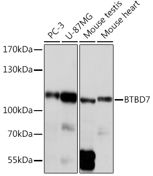 BTBD7 Polyclonal Antibody (E-AB-91995)