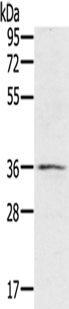 p53RFP Polyclonal Antibody (E-AB-15118)