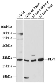 PLP1 Polyclonal Antibody (E-AB-90765)