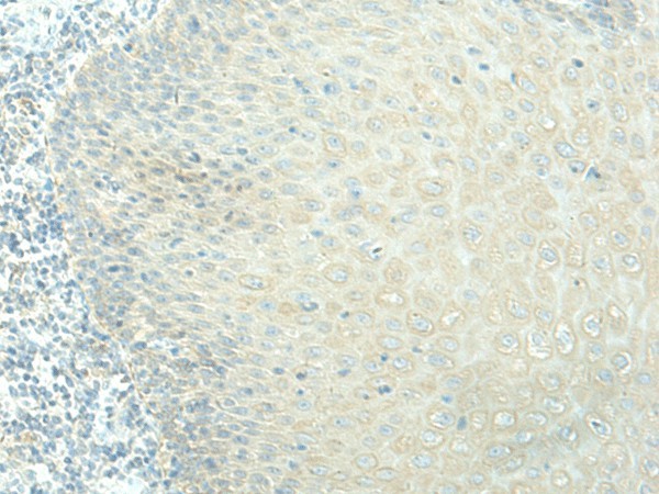 EVI2B Polyclonal Antibody (E-AB-19827)