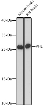 VHL Polyclonal Antibody (E-AB-66748)