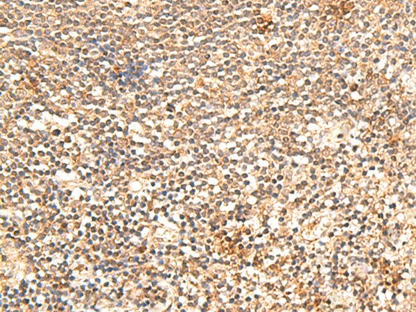 TRAPPC1 Polyclonal Antibody (E-AB-52885)