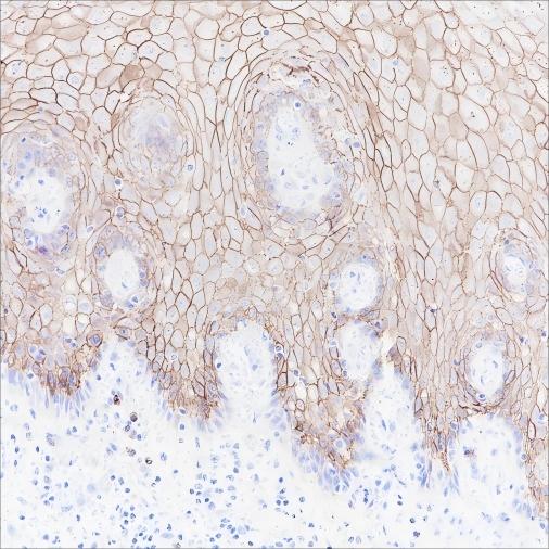 Recombinant CD138/Syndecan-1 Monoclonal Antibody (AN301463L)