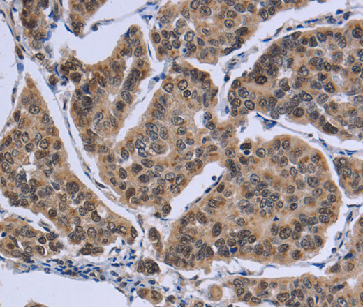 IPO8 Polyclonal Antibody (E-AB-13337)