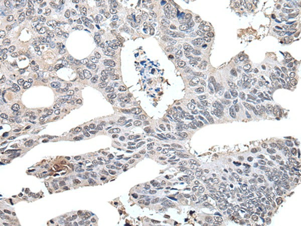 TCEB2 Polyclonal Antibody (E-AB-18260)