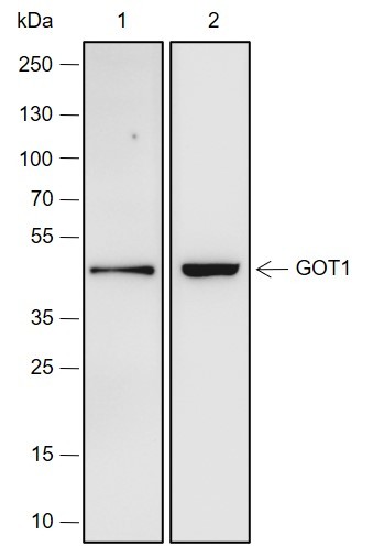 Recombinant GOT1 Monoclonal Antibody (AN301537L)
